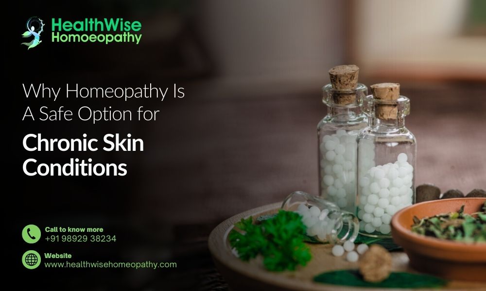 why-homeopathy-is-a-safe-option-for-chronic-skin-conditions